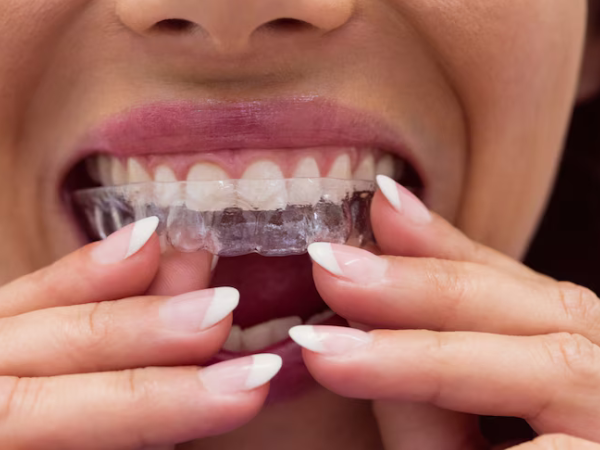 Invisalign in Atlanta