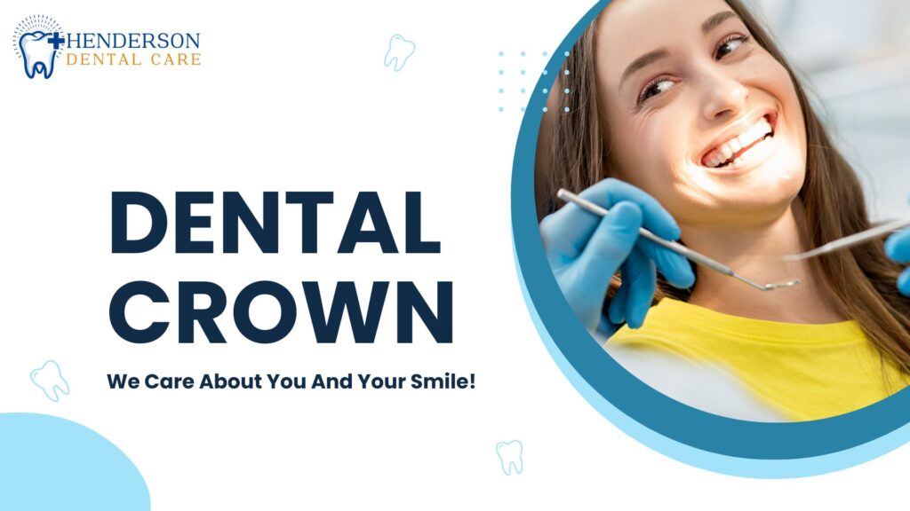 Dental Crown IN Atlanta