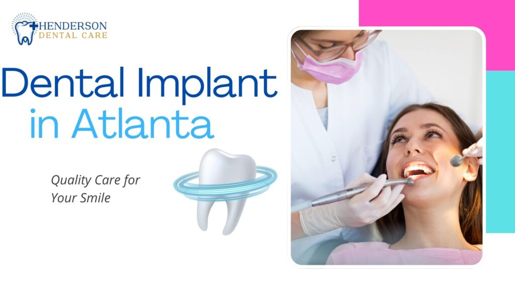 Dental Implant in Atlanta