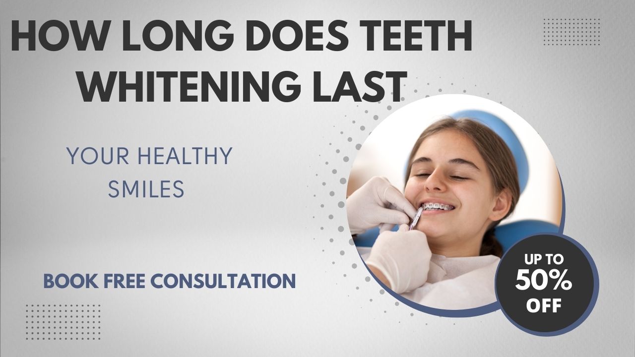 How Long Does Teeth Whitening Last